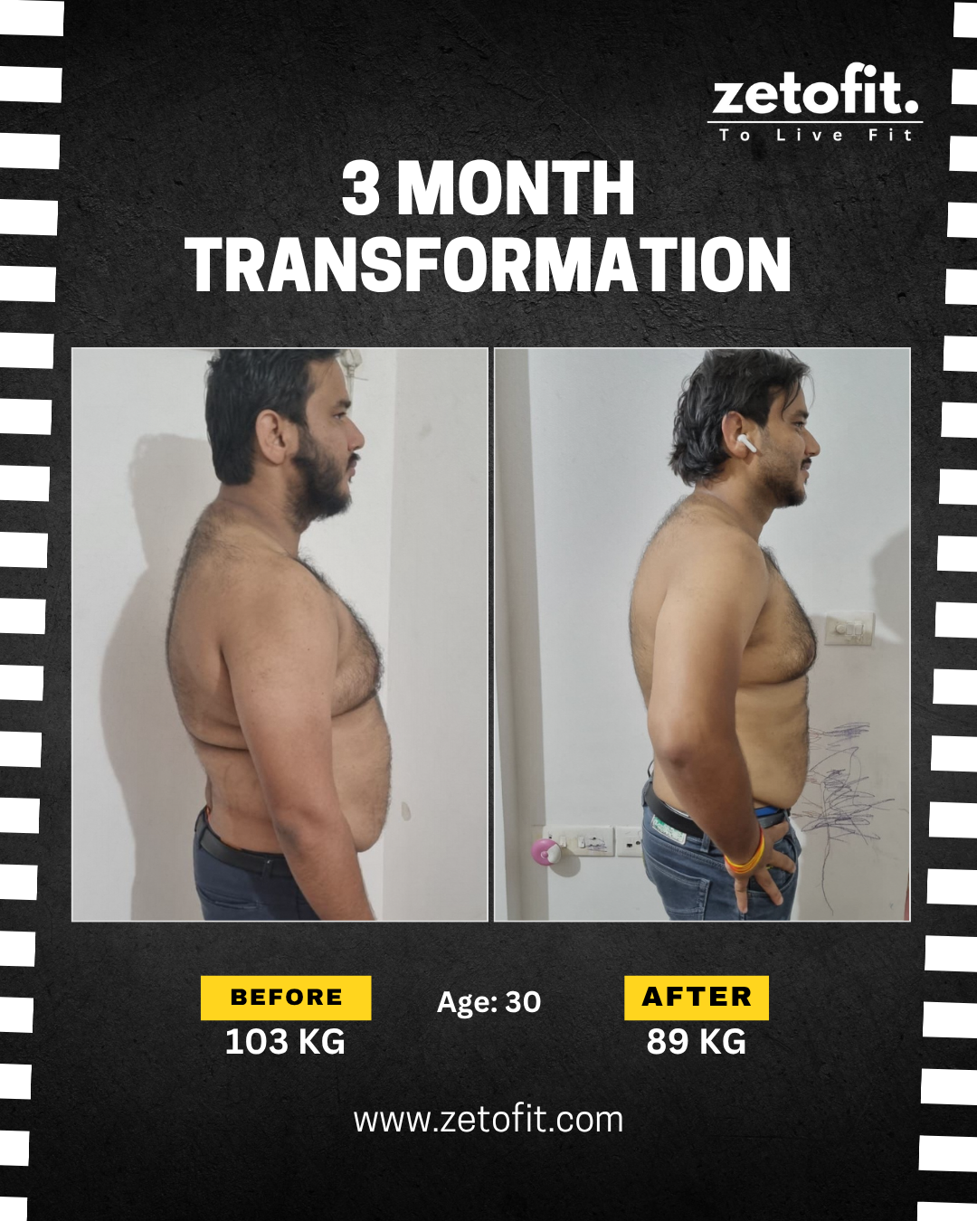 belly-fat-loss-before-after-pune.jpg